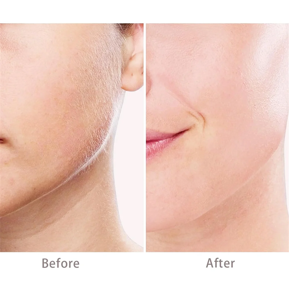 Generation 3 Facial Hair Remover Replacement Heads