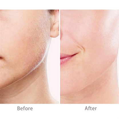 Generation 3 Facial Hair Remover Replacement Heads